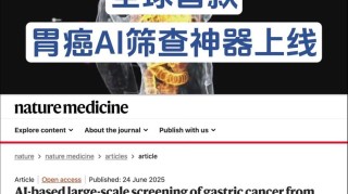 全球首个胃癌影像筛查AI模型发布