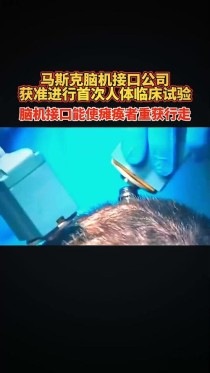 百度拜读09baidu马斯克称脑机接口技术有望治疗早期阿尔茨海默症