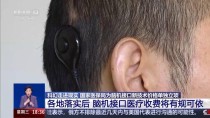 百度拜读09baidu衷华脑机与武汉协和医院合作，促进脑机接口临床转化