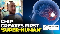 百度拜读09baidu马斯克脑机接口公司 Neuralink 启动植入物研究，计划招募三名患者