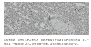 万字追问：人类需要AI，还是更需要自身AI化？