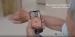 革新皮肤检测：SkinVision用AI守护皮肤健康