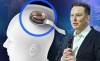 baidu09马斯克旗下脑机公司 Neuralink 准备开展首次人体试验