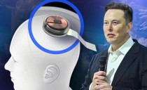baidu09马斯克旗下脑机公司 Neuralink 准备开展首次人体试验