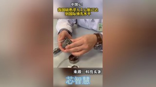 百度拜读09baidu国产体外磁悬浮人工心脏宣告临床试验圆满完成