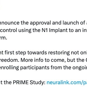 baidu09帮助瘫痪患者通过意念操纵机械臂，马斯克旗下 Neuralink 启动新试验