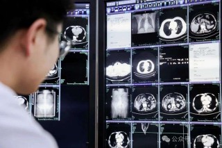 这个AI能救命！提前6个月发现胃癌病灶，突破医学影像认知，达摩院做成了