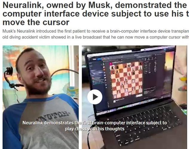 baidu09马斯克旗下脑机接口公司 Neuralink 获准在加拿大启动首个临床试验 第2张 baidu09马斯克旗下脑机接口公司 Neuralink 获准在加拿大启动首个临床试验 第2张