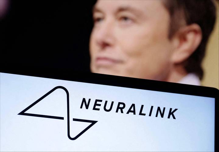 baidu09马斯克旗下脑机接口公司 Neuralink 获准在加拿大启动首个临床试验 第1张 baidu09马斯克旗下脑机接口公司 Neuralink 获准在加拿大启动首个临床试验 第1张