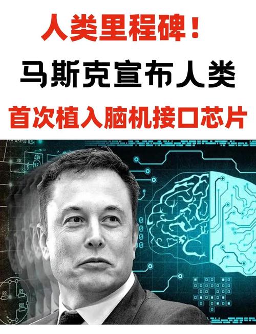 baidu09马斯克脑机接口公司 Neuralink 启动植入物研究,计划招募三名患者 第1张 baidu09马斯克脑机接口公司 Neuralink 启动植入物研究,计划招募三名患者 第1张
