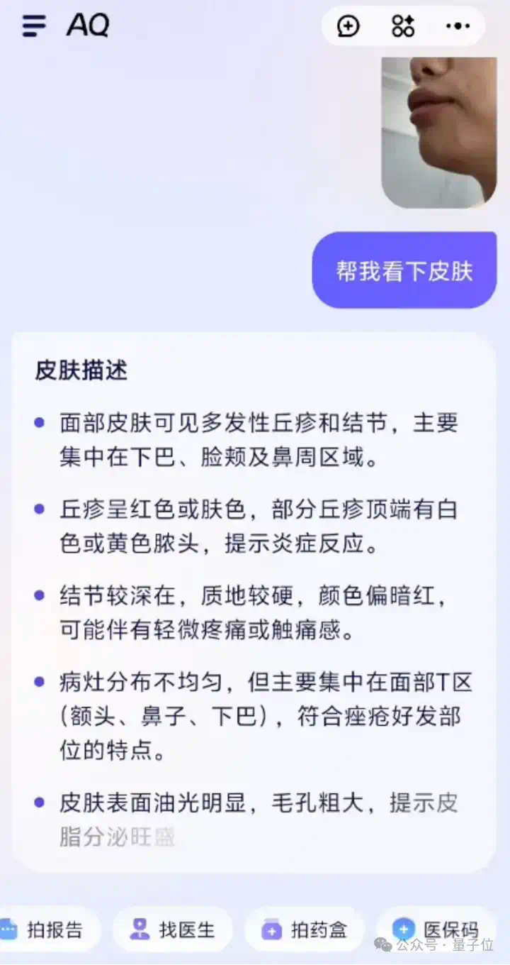 真·全民AI健康管家来了！实测蚂蚁AQ：追问识药看皮肤，还能连医院接硬件  第5张