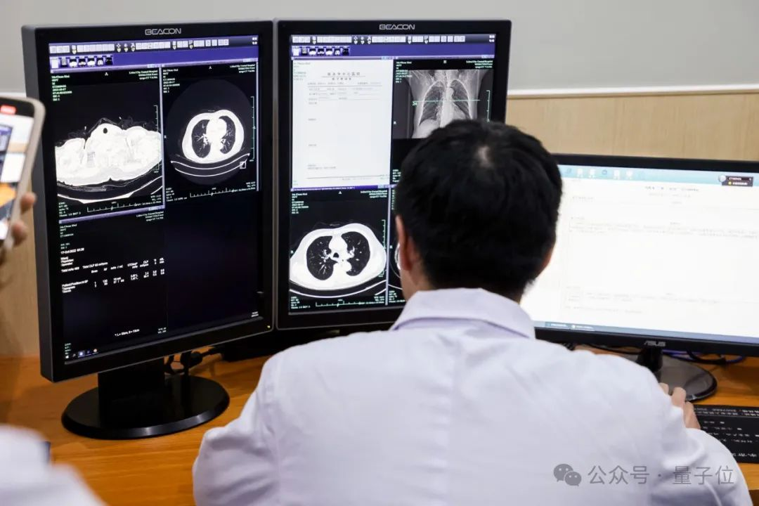 浙江丽水，正在用AI诊癌  第4张