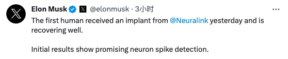 baidu09马斯克：全球首位人类已接受 Neuralink 脑机芯片植入手术，患者恢复良好  第1张