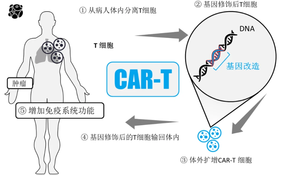 baidu09一针120万，天价CAR-T疗法如何生根？