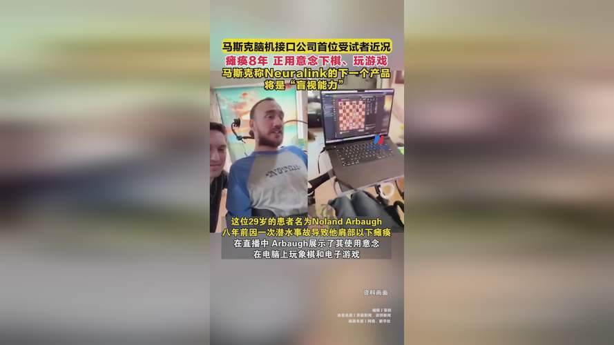 百度拜读09baidu被曝正面临美国联邦调查,马斯克脑机接口公司Neuralink涉嫌侵犯动物福利 第1张 百度拜读09baidu被曝正面临美国联邦调查,马斯克脑机接口公司Neuralink涉嫌侵犯动物福利 第1张